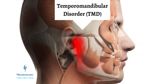 Temporomandibular Disorder (TMD) | Dubai, UAE | Westminster Ortho Med