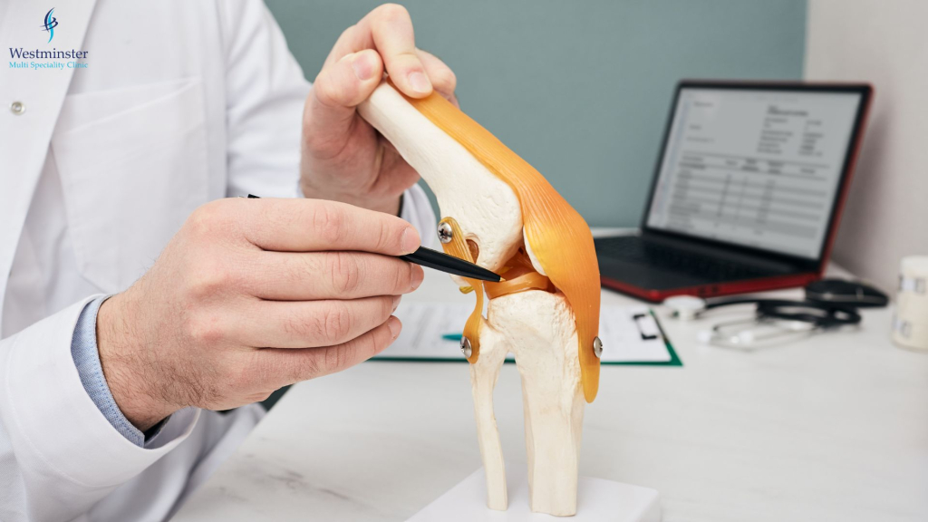 ACL Tear Treatment - Orthopedics - Dubai