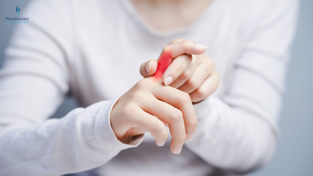 Arthritis Management - Orthopedics - Dubai