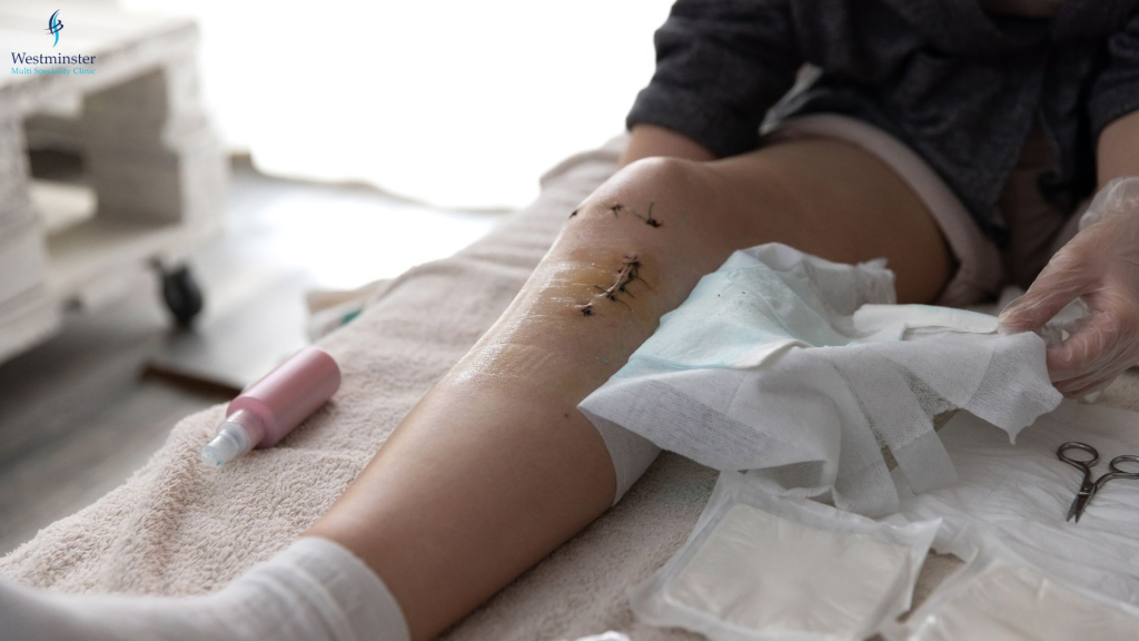 Post-Traumatic Malunion Correction - Orthopedics - Dubai